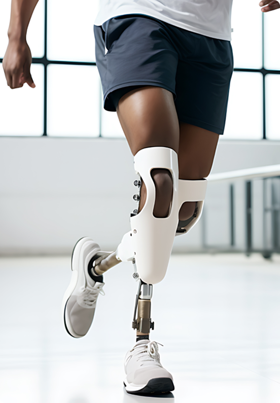 Person with prosthetic leg